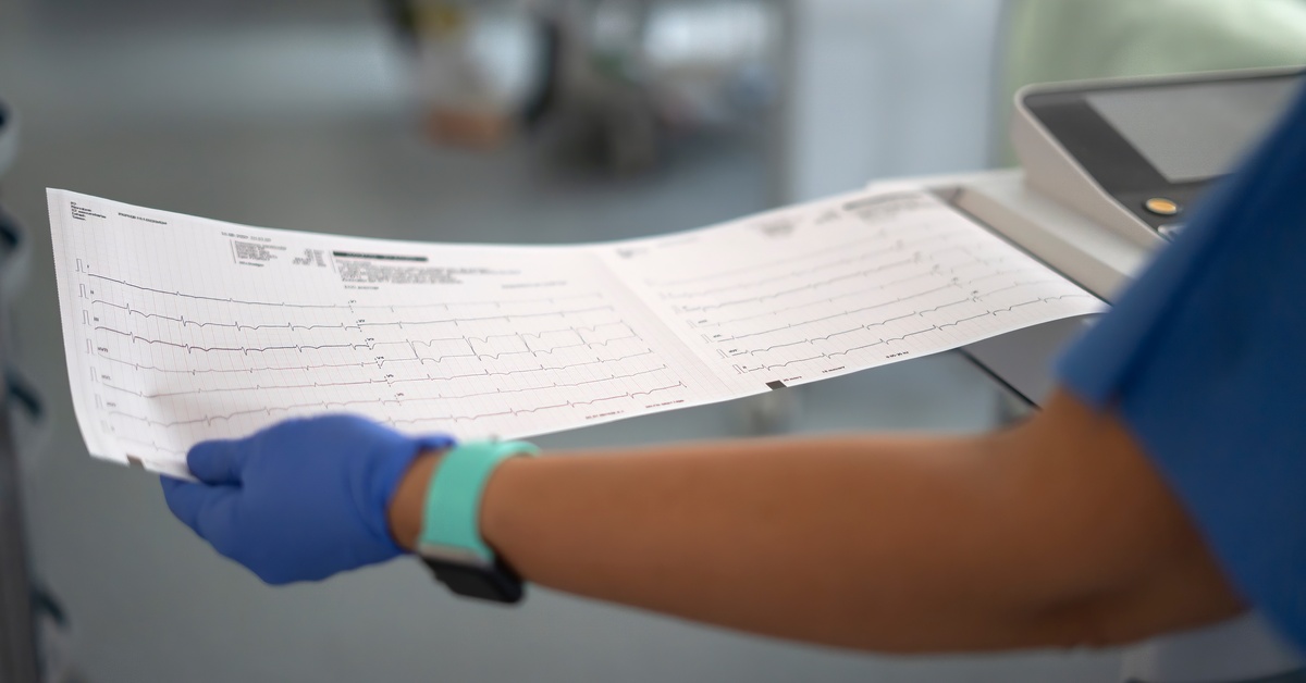 Gloved healthcare worker holding ECG printout with heart rhythm lines, reviewing results in clinical setting.